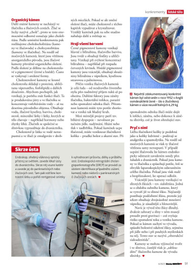 100+1 Zázraky medicíny 6/2025, Page 51